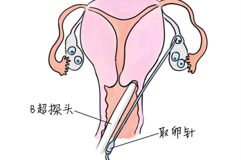 http://wulumuqi.vdtfzz.com/post/205.html|乌鲁木齐供卵助孕